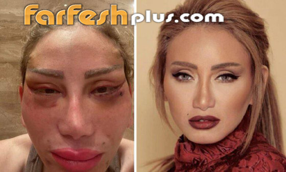 ريهام سعيد تفتح قضية طبيب التجميل اللبناني نادر صعب.. أنت دمرتني وشوهتني! صورة رقم 10