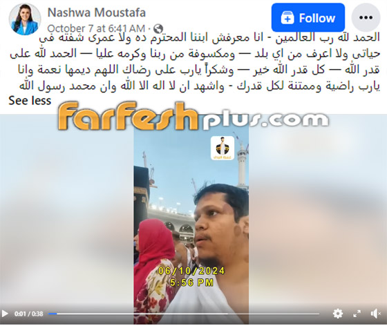 ‏بعد خضوعها لجراحة في القلب، نشوى مصطفى تشارك موقف مؤثر لأحد المعجبين صورة رقم 1