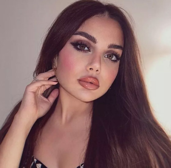 بشفاه منتفخة، زينب فياض ابنة هيفاء وهبي تكشف عمليات التجميل التي أجرتها! صورة رقم 9